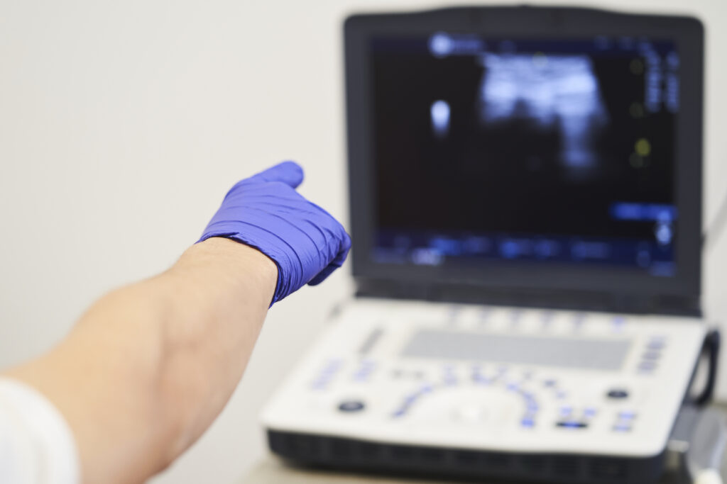 ultrasound scan at the fertility clinic. Doctor pointing at the screen